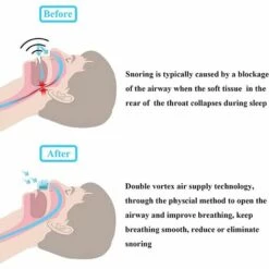 ZHUOXUAN Anti-Ronflement, Dispositifs Anti Ronflement Efficace, Orthese Appareil Anti Ronflement, Dilatateur Nasal Anti Ronflement -Protection des voies respiratoires Soldes 51450460 3