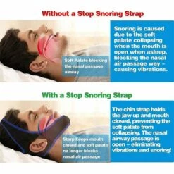 Anti Ronflement Efficace - Sans Apnée Sommeil Masques, Jugulaire Anti Ronflement, Stop Ronflement Solution Mentonnière, Arrêter De Ronfler Pour Hommes Femmes, Dispositifs Anti Ronflement-Triomphe -Protection des voies respiratoires Soldes 55684280 5