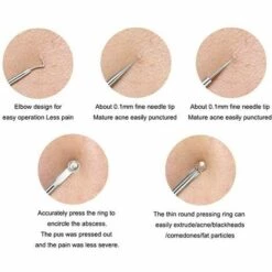 Outillage Ensemble D'outils De Suppression Noire, Ensemble De 4 Pièces, Avec Boîte De Rangement Pour Soins Faciaux Pour Le Nez En Argent LangRay -Protection des voies respiratoires Soldes 64036301 4